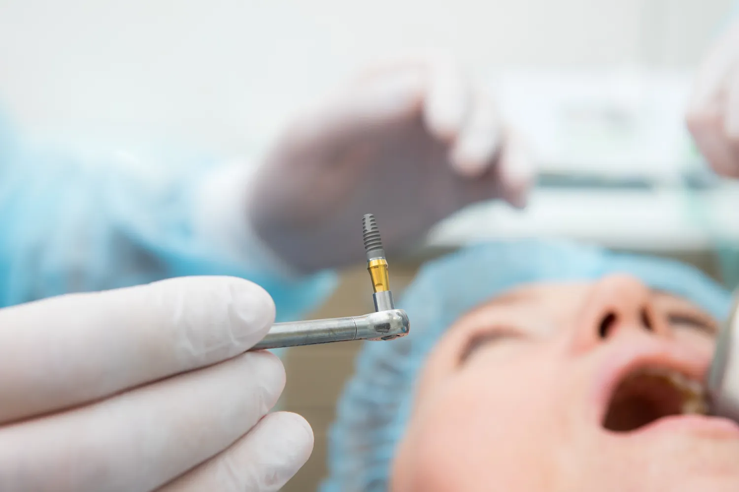 Co należy wiedzieć przed wyborem implantu zęba?