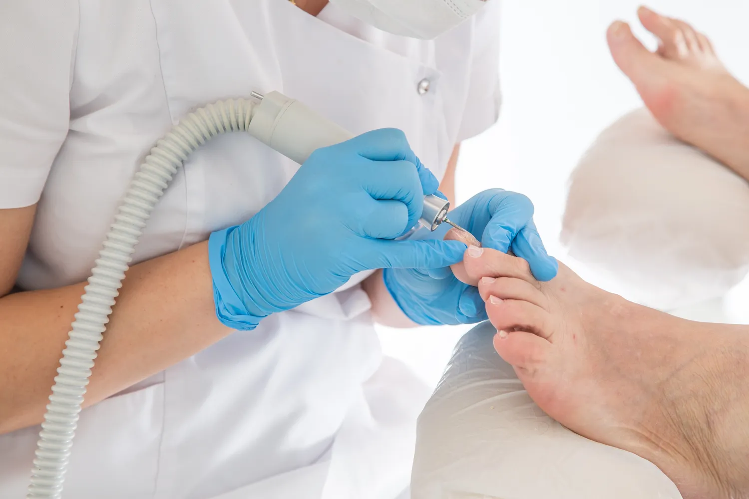 Pedicure leczniczy