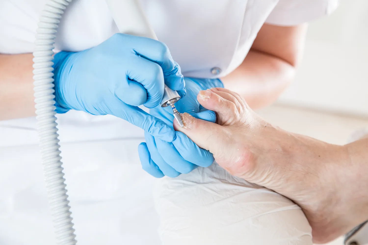 Pedicure leczniczy Szczecin