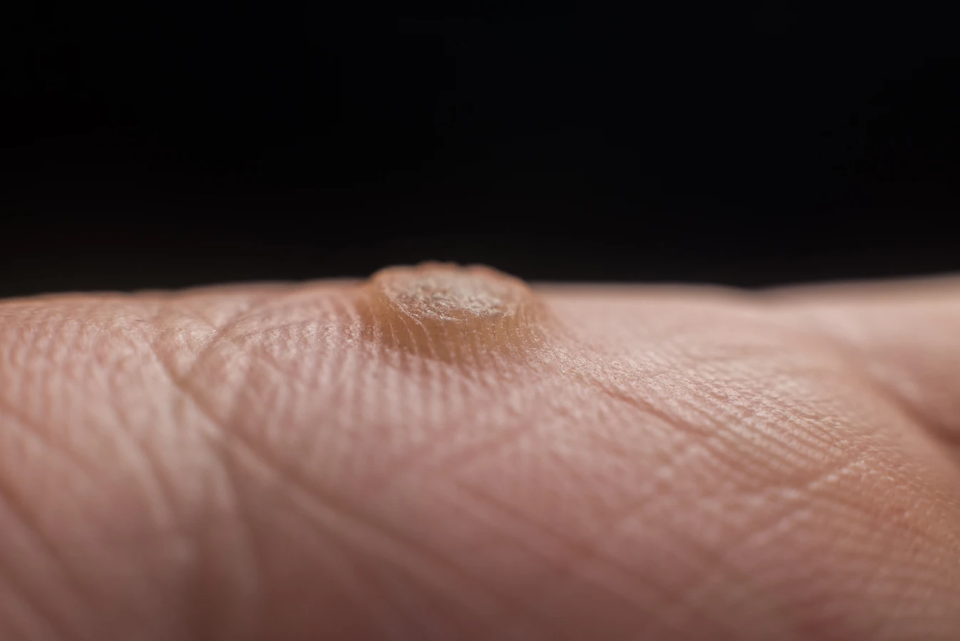 Pedicure leczniczy Warszawa