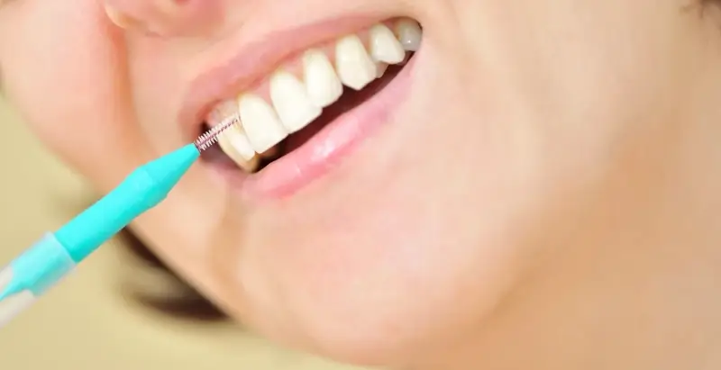 Najlepszy licówki porcelanowe Szczecin